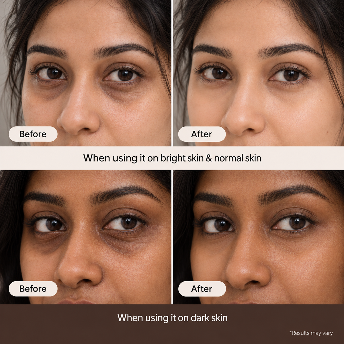 Calcium Under Eye Cream – Dark Spot & Fine Line Care