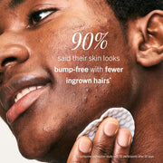 Foliclear Ingrown Hair Pads